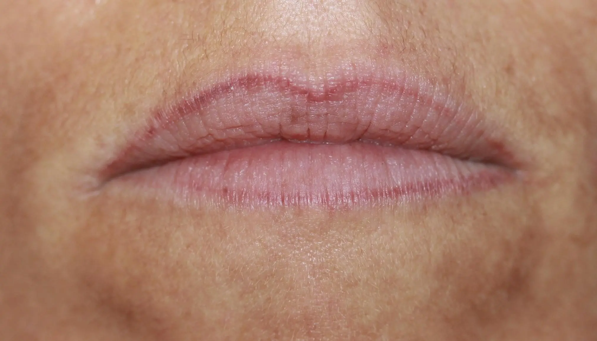 Ausbesserung einer Lippe mit Permanent Make Up Vorher