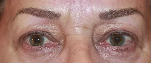 Augenbrauen drei Wochen nach der Erstbehandlung mit Permanent Make Up Härchentechnik